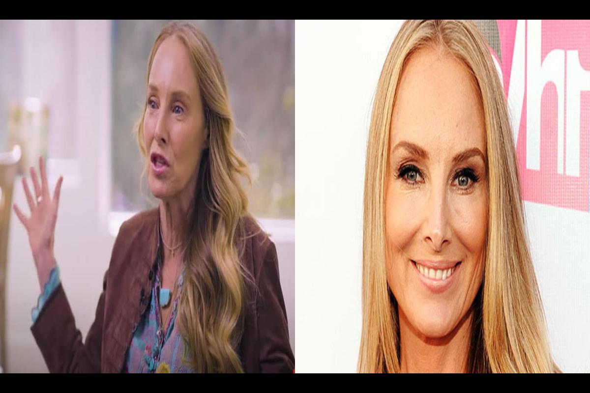 Chynna Phillips' Tumor Surgery Announcement